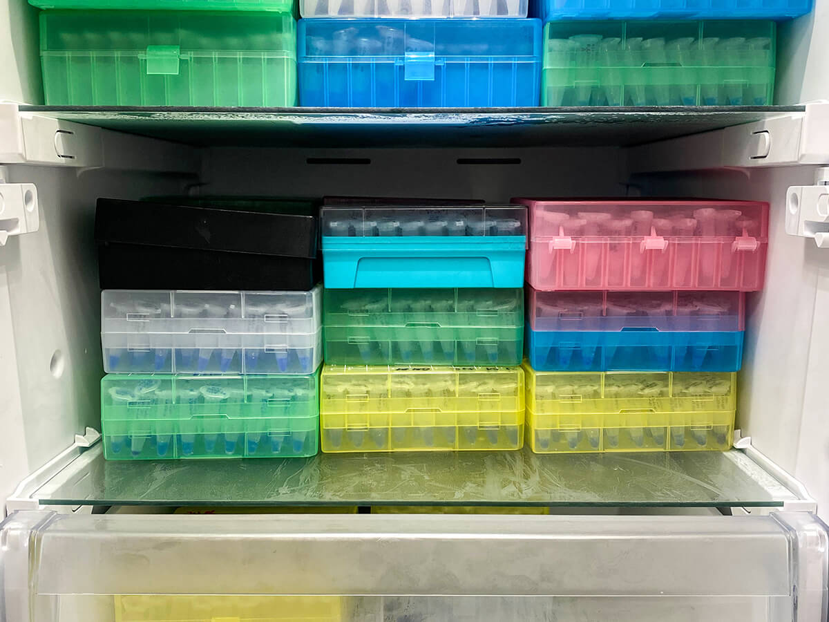 Tricks to Organize Your Lab Freezer for Maximum Efficiency – 360medical.ca